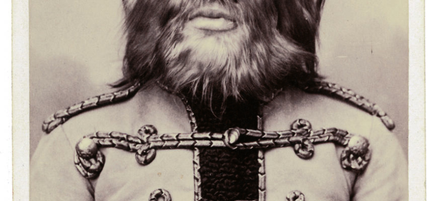 gipertrihoz