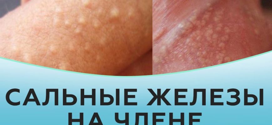 salnye zhelezy